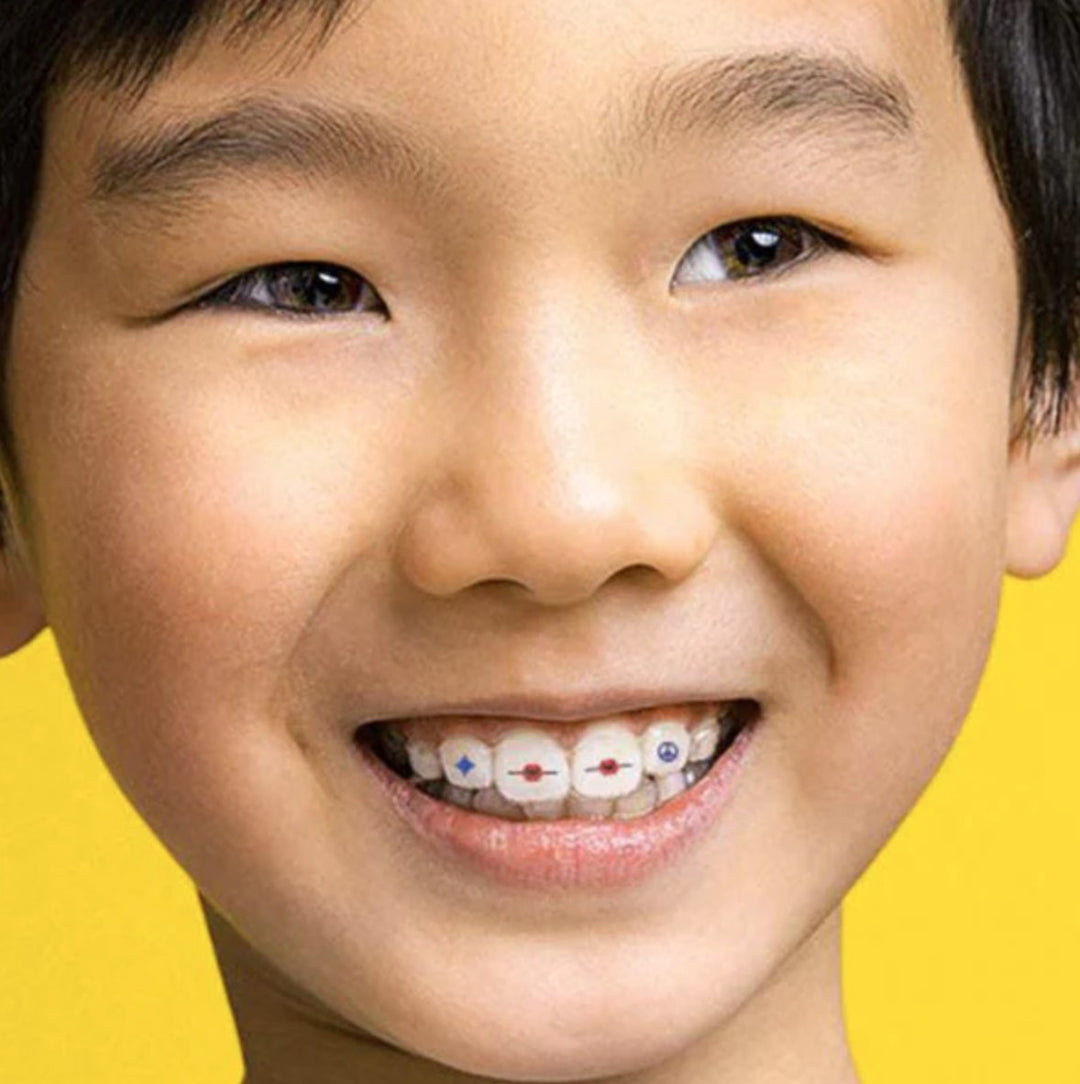 Invisalign Aligner Case Great Wave – Invisalign Accessory Store UK